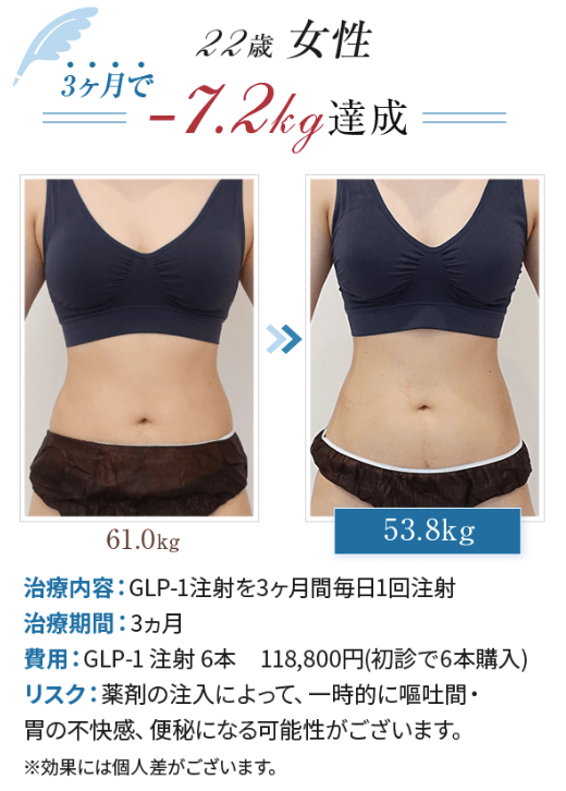 エミシアクリニック、GLP-1ダイエットの症例写真1