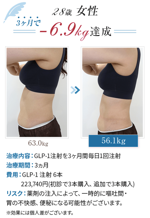 エミシアクリニック、GLP-1ダイエットの症例写真2