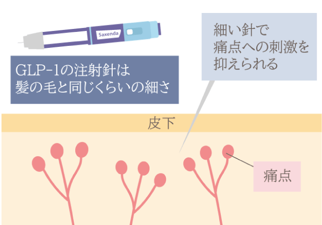 GLP-1の注射方法