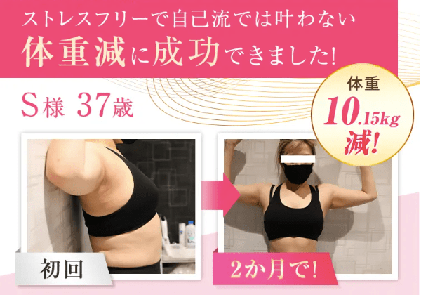 ファイヤークリニック、医療ダイエットの症例写真1-A