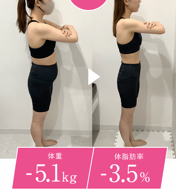 グロウクリニック、医療ダイエットの効果、症例写真1