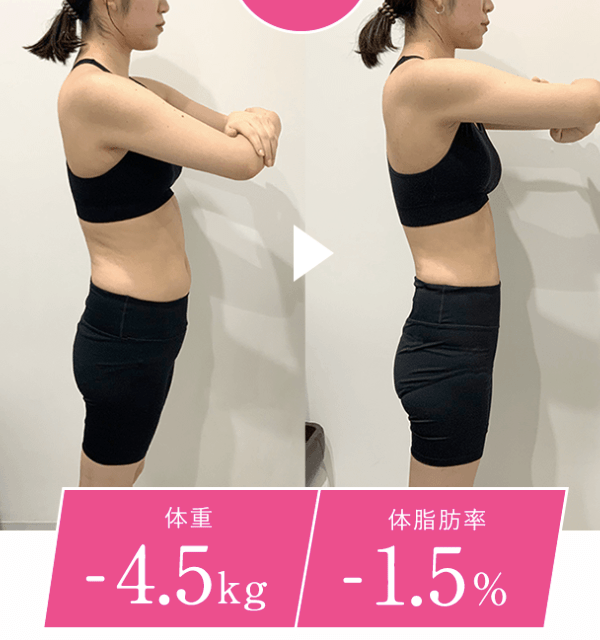 グロウクリニック、医療ダイエットの効果、症例写真2