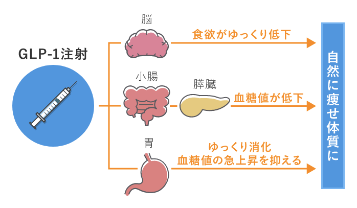 ミラクリニックのGLP-1注射を解説