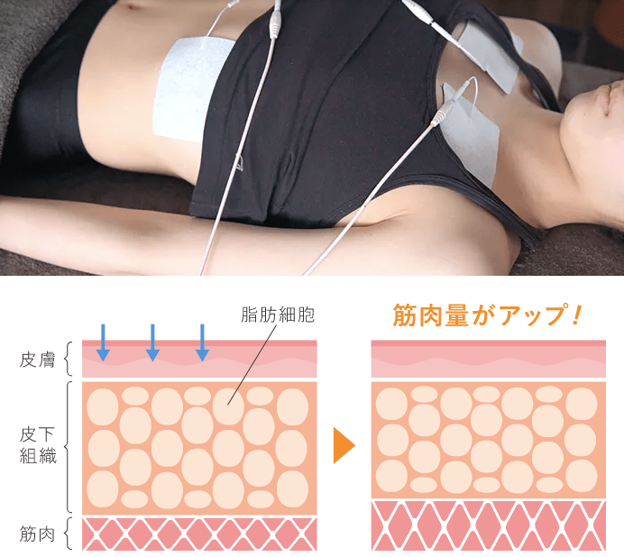 ミラクリニックの医療EMS