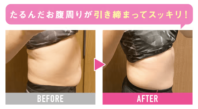クリニックフォア、GLP-1ダイエットの効果1