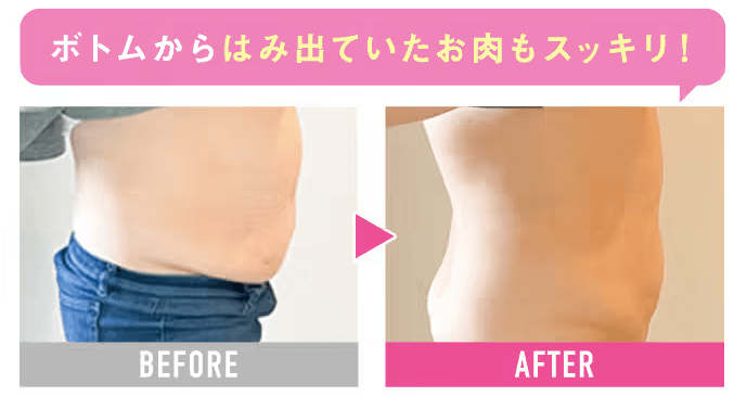 クリニックフォア、GLP-1ダイエットの効果2