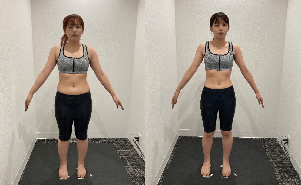 ディオクリニック、医療ダイエットの症例写真