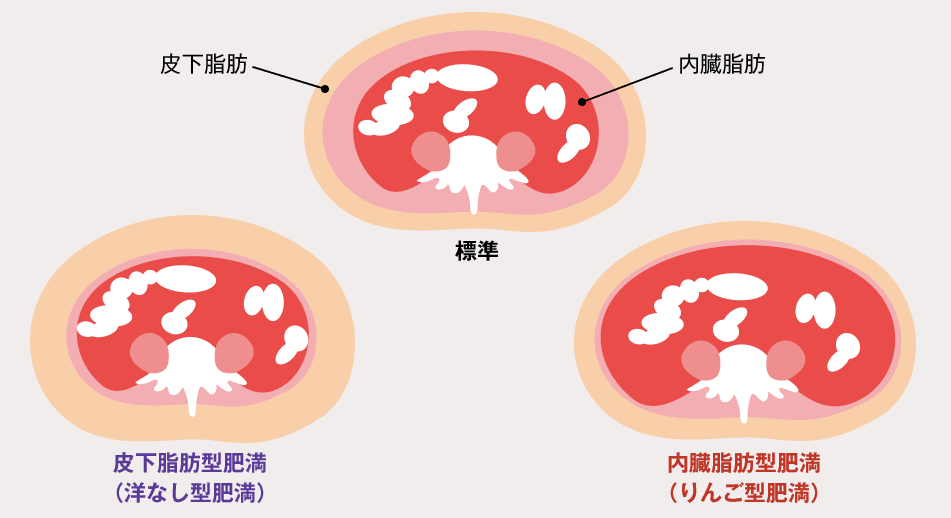 皮下脂肪と内臓脂肪を比較